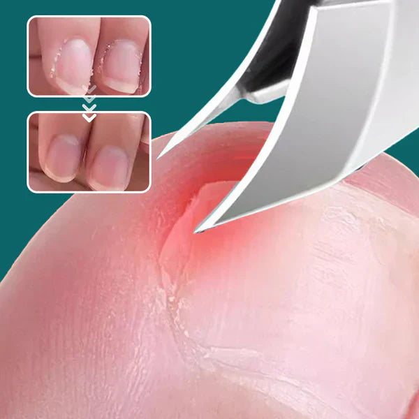 Antislip nagelknipper met afgeschuinde rand, set van 3