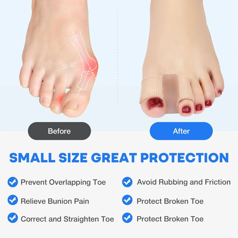 🦶✨ Toe Separator & Bunion Corrector – Smärtfri Hallux Valgus & Overlapping Toe Relief för Damer & Herrar! ✨👟